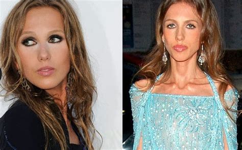 allegra versace problemas alimenticios